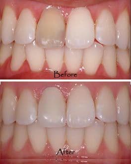 Thousand Oaks Dental 3