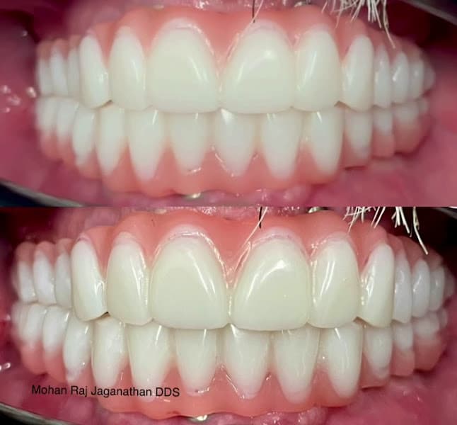 Elite Dental - Mohan Raj Jaganathan DDS & Veena Raja DDS PhD 3