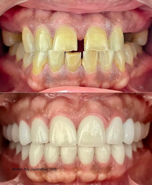 Elite Dental - Mohan Raj Jaganathan DDS & Veena Raja DDS PhD 4