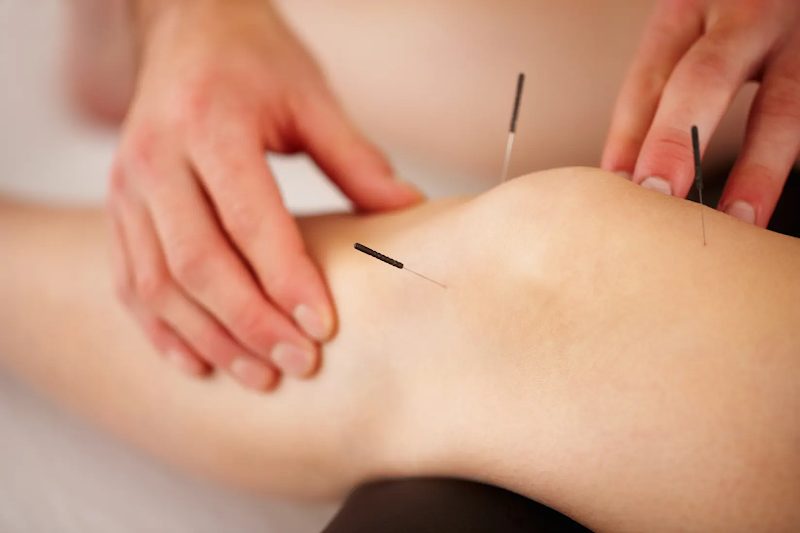 Laina Li Acupuncture 2