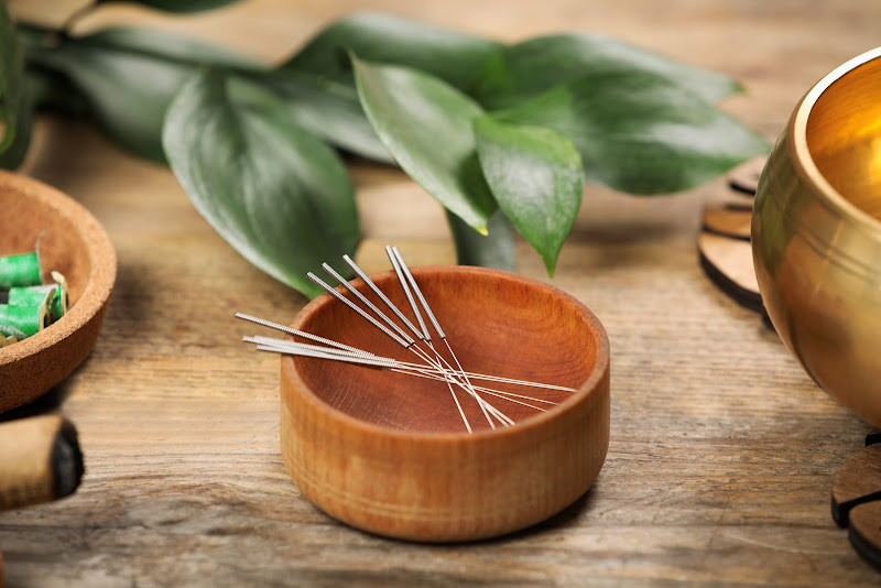 Acupuncture For Athletics 3