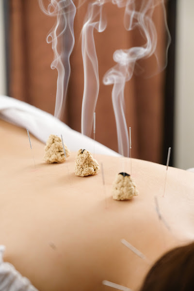 Sabine Huey Acupuncture 5
