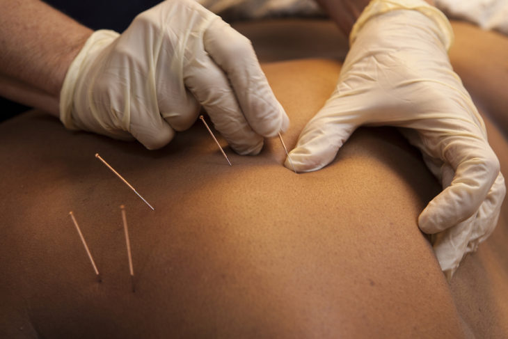 Yuling Acupuncture Clinic 2