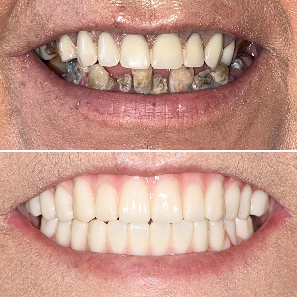Itani Dental San Francisco: Dentistry to Your Door® 4