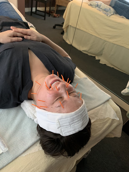 Rejuvenate Acupuncture & Massage 2