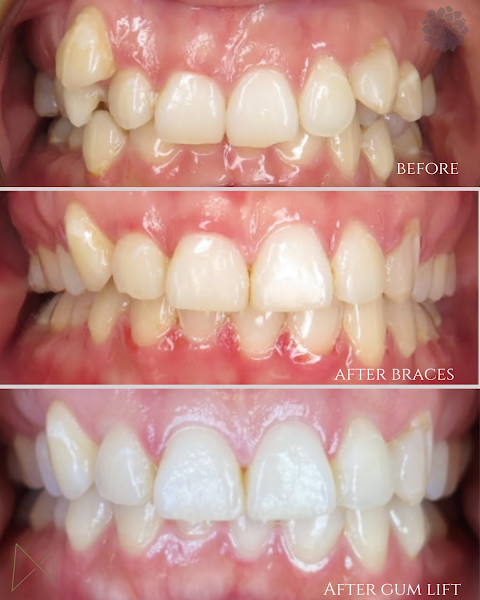 Mowry Dental 2
