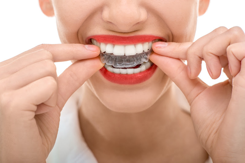 Dr. Bina B. Joshi DDS 3