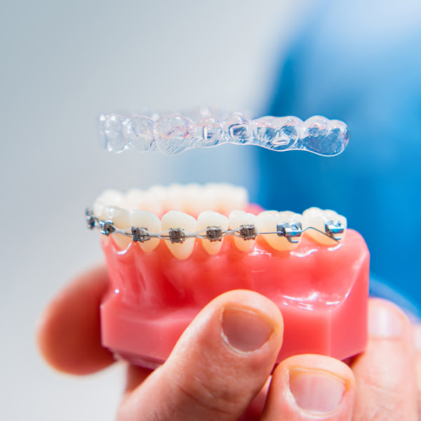 East Bay Dental - Dental Implants, Orthodontist Dentist 1