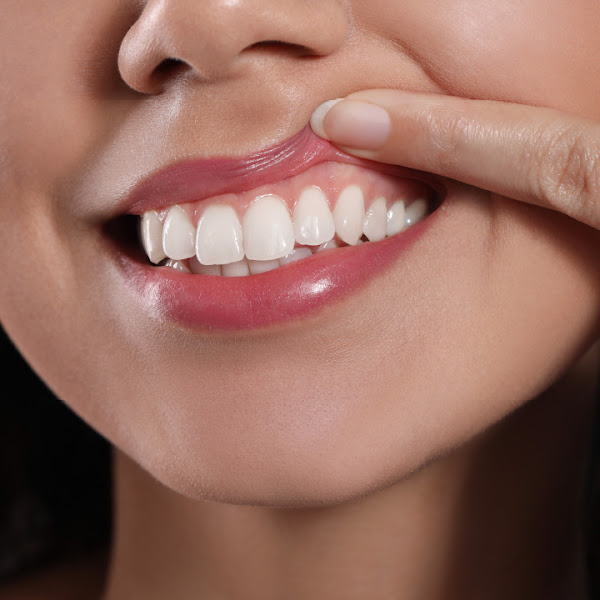 East Bay Dental - Dental Implants, Orthodontist Dentist 4