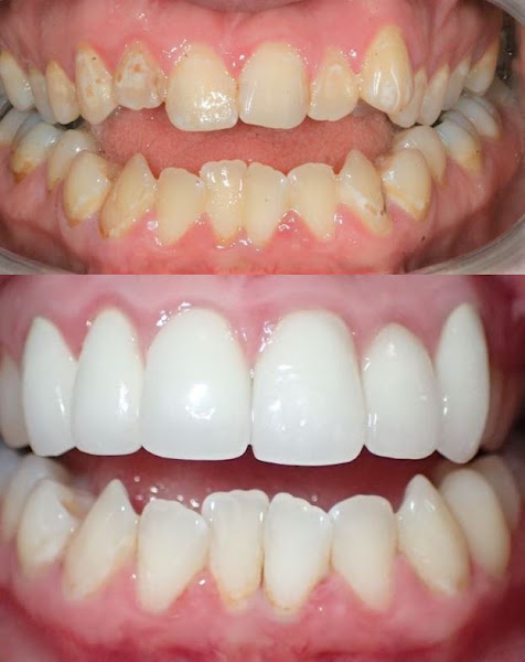 Bay Area Dental, Airway & Sleep 3