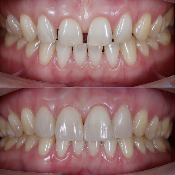 Hayward Dental Arts 2