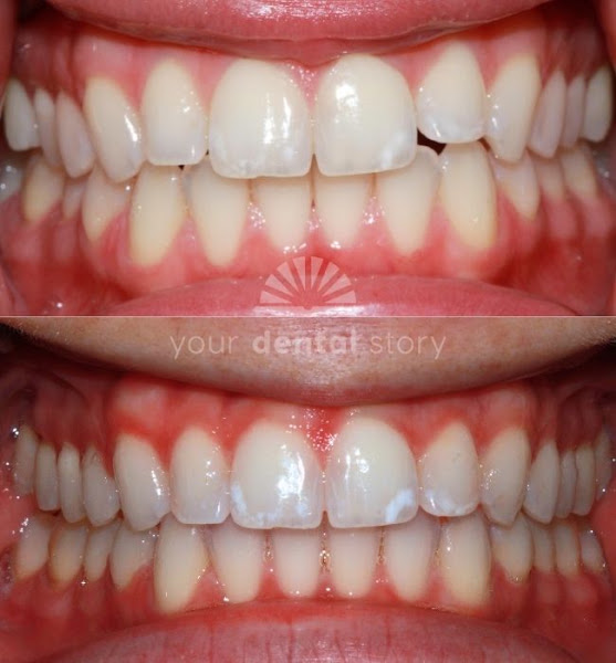 Your Dental Story - Berkeley Dentist 2