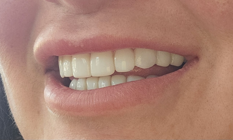 Channing Dental 2