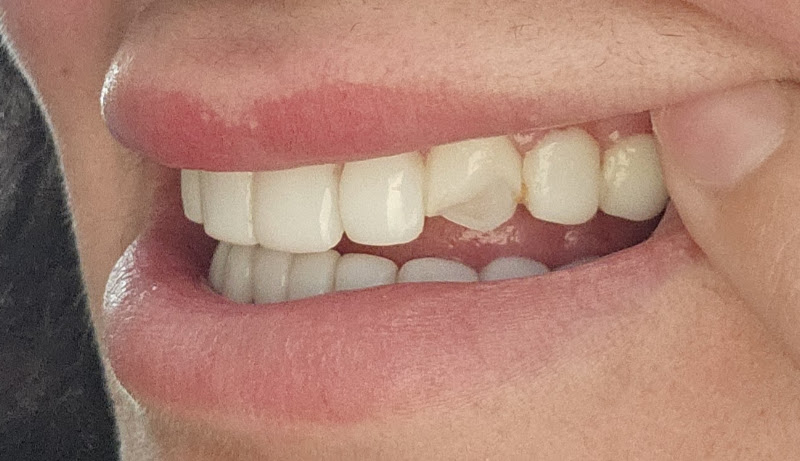 Channing Dental 3