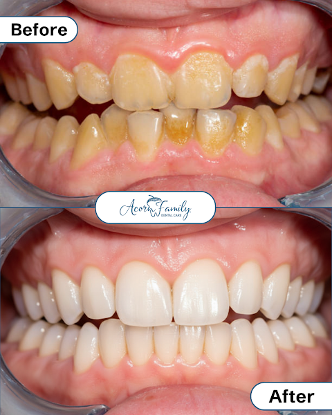 Acorn Family Dental Care 2