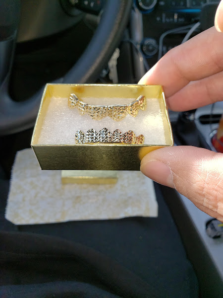 TNB Gold Teeth