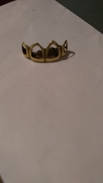 TNB Gold Teeth 3