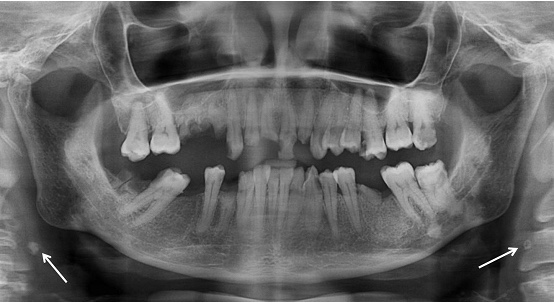 Nice Dental, Shiyu Wang, DDS, San Leandro