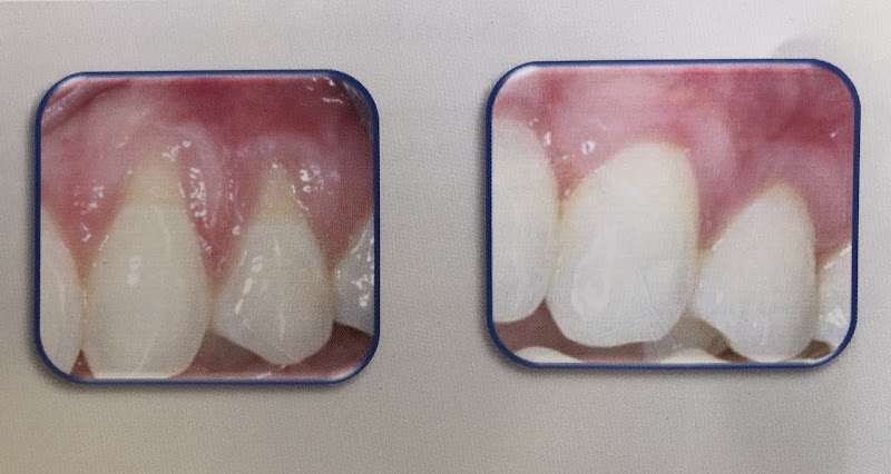 Nice Dental, Shiyu Wang, DDS, San Leandro 3