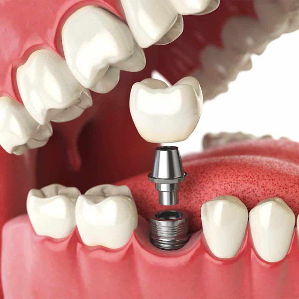 Nice Dental, Shiyu Wang, DDS, San Leandro 4