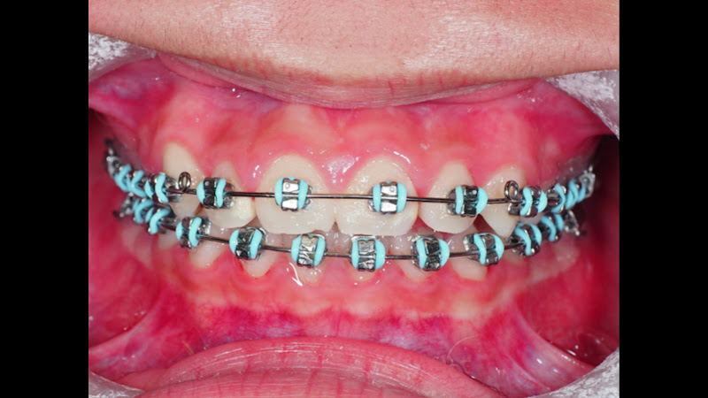 The Favour Dental: Cam Ngoc Dong, DDS 2