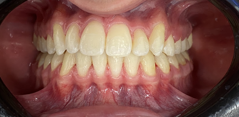 Chloe Dental Houston 5