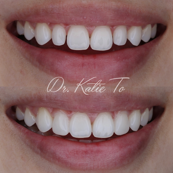 Dr. Katie To, Center for Wellness Dentistry - Diagnostic & Prevention 3