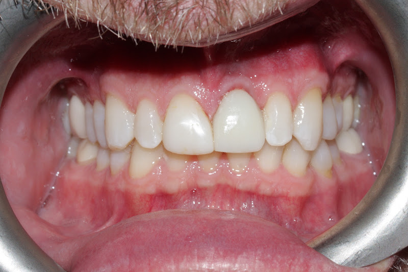 Grand Smiles Dental 3