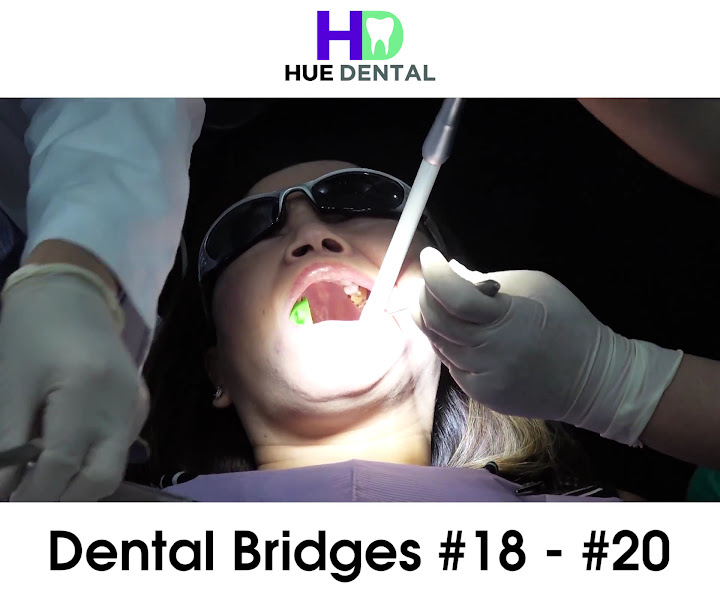 Hue Dental 2
