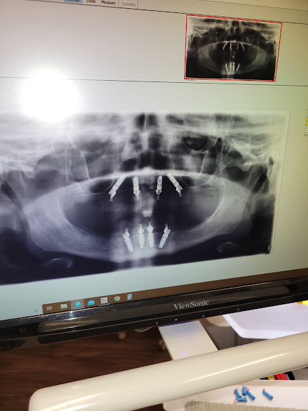 360 Family and Implant Dentistry- Dr. Ticole Nguyen and Dr. Christopher Gonzales 2
