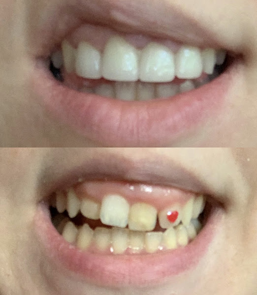 Dental Access 2