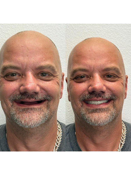 Archie Dental 2