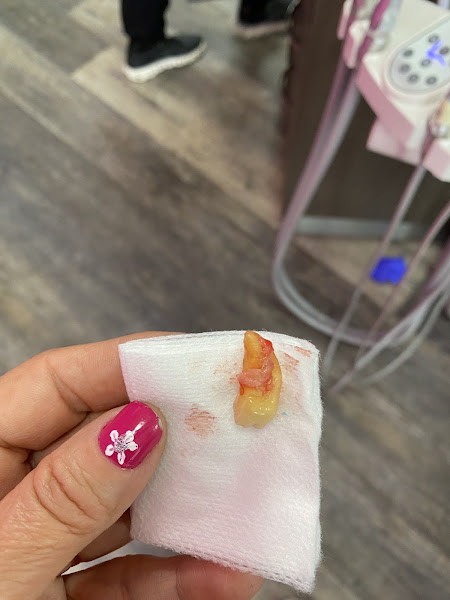 Root Canal Dentists 3