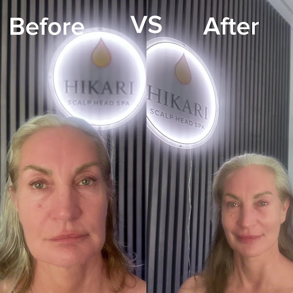 Hikari Head Spa | Facial Sculpting & TMJ Relief 2