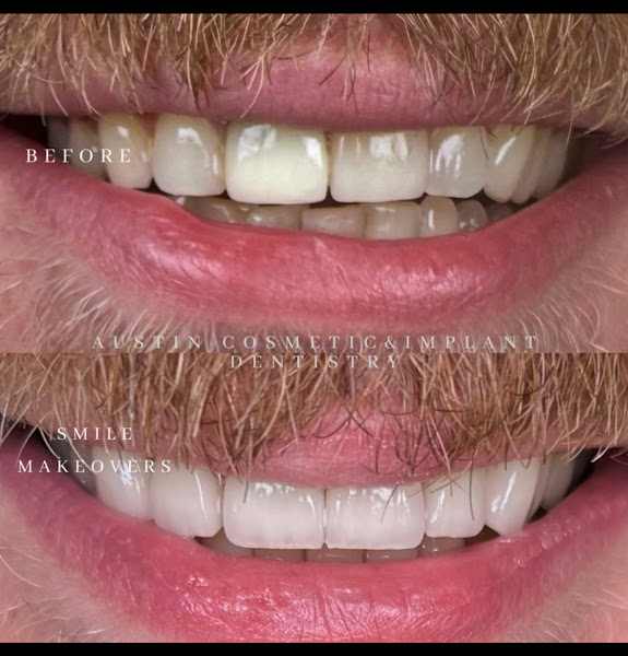 Austin Cosmetic and Implant Dentistry
