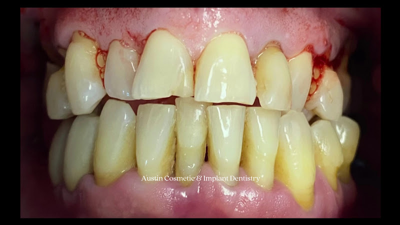Austin Cosmetic and Implant Dentistry 2