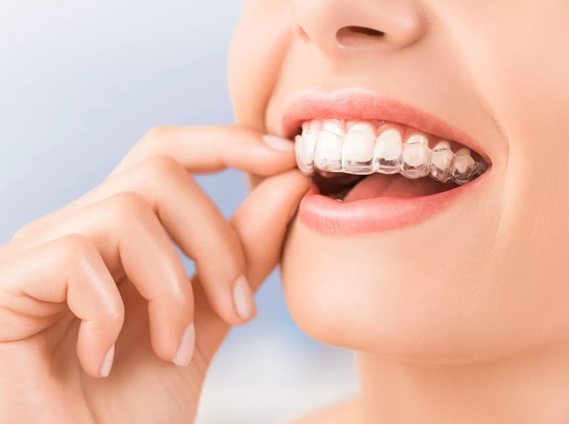 Lotus Dental Son Nguyen DDS 3