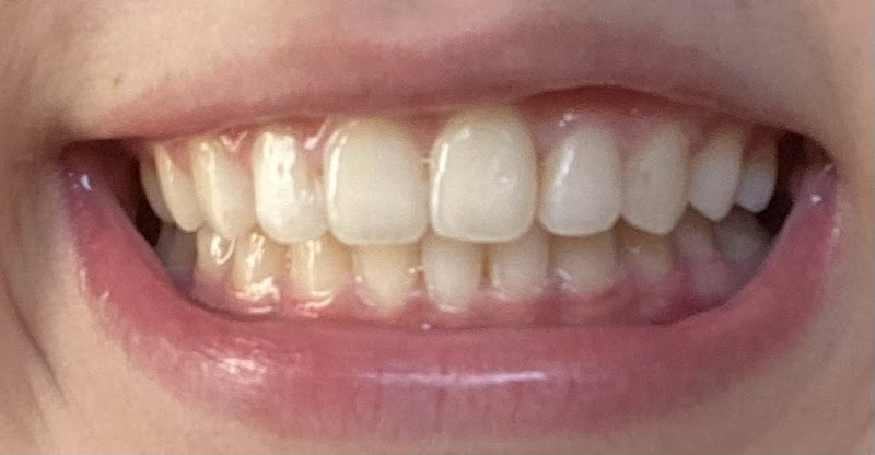 Lighthouse Dental Group CN Braces- Dr. Christopher H. Nguyen 2