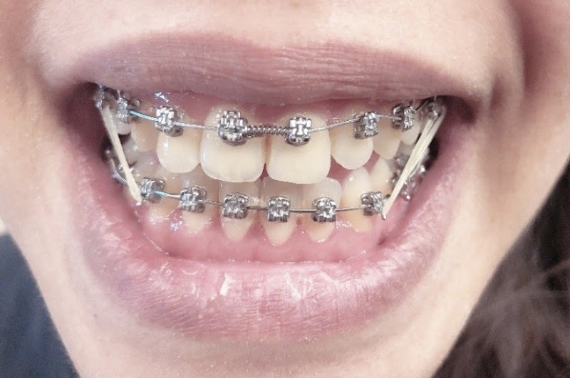 Lighthouse Dental Group CN Braces- Dr. Christopher H. Nguyen 3