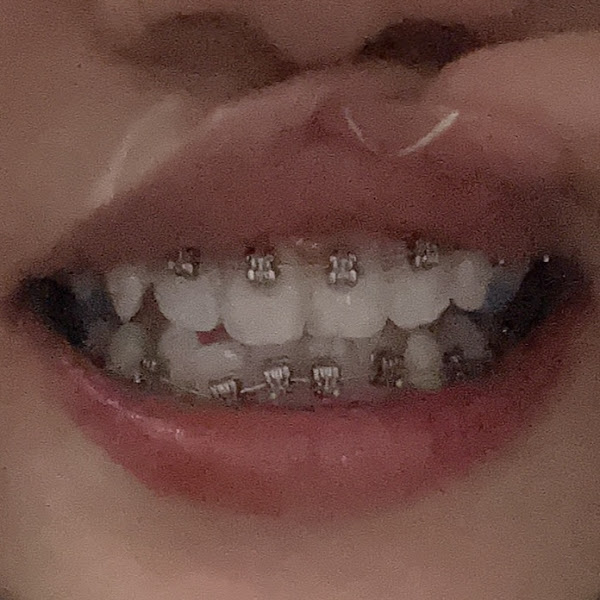 Lighthouse Dental Group CN Braces- Dr. Christopher H. Nguyen 4