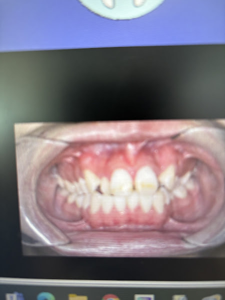 Lighthouse Dental Group CN Braces- Dr. Christopher H. Nguyen 5