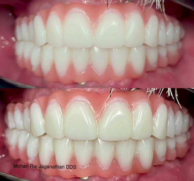 Elite Dental - Mohan Raj Jaganathan DDS & Veena Raja DDS PhD 3