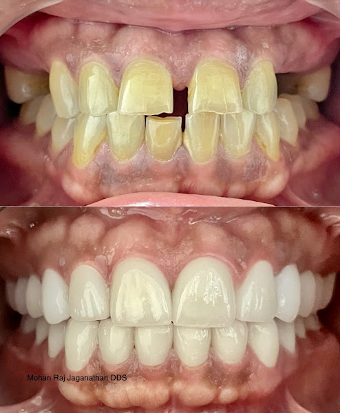 Elite Dental - Mohan Raj Jaganathan DDS & Veena Raja DDS PhD 4