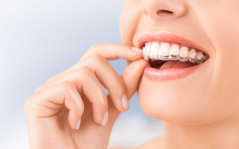The OrthoBee Orthodontics - Chi H. Bui, DMD, MS 5