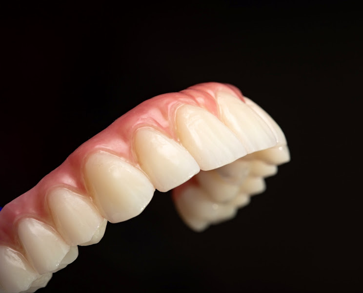 Smile For Success Dental Center - Tim Do Nha Khoa Lab Denture, Implant & Crown 4