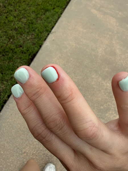 Nails Now