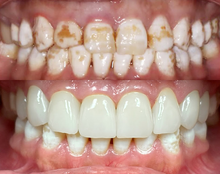 Arte Dental & Orthodontics Plano