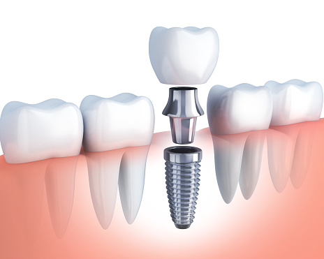 Arte Dental & Orthodontics Plano 5
