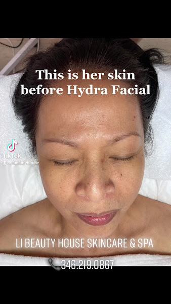 Lì Beauty MedSpa | Houston 2