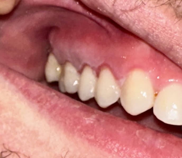 Fort Bend Periodontics and Implantology 4